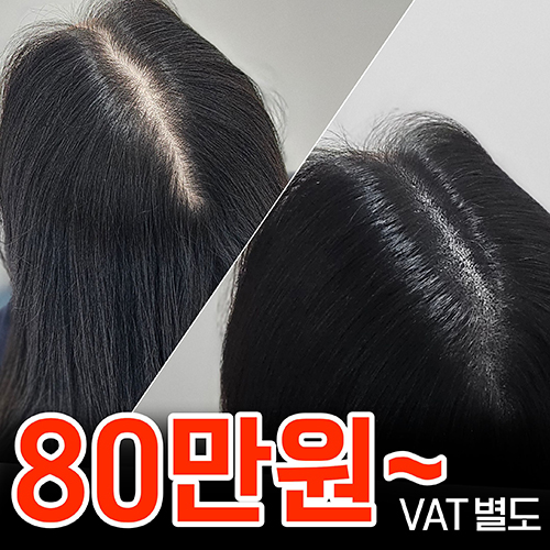 가르마 사례
